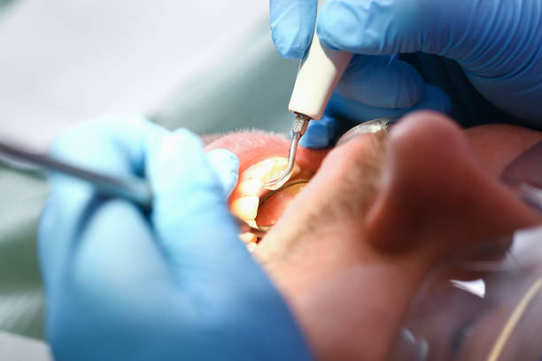 Best Urgent Care for Lost Fillings or Crowns in Billington Heights, NY
